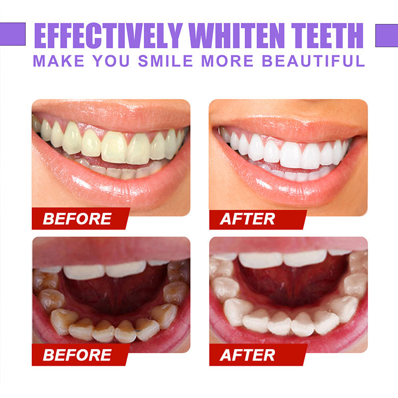 Hjemix | Dental Color Corrector