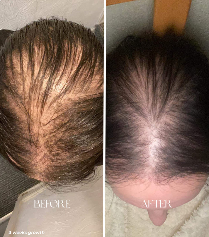 Hjemix | Håroljeapplikatorflaske