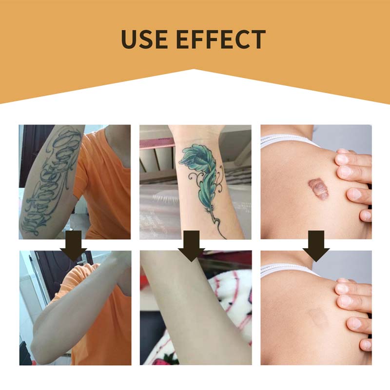 Hjemix | Skin Usynlig Concealer Patch