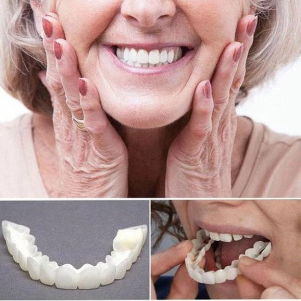 Hjemix | På Smile Veneers (Øvre og Nedre Kjeve inkludert)