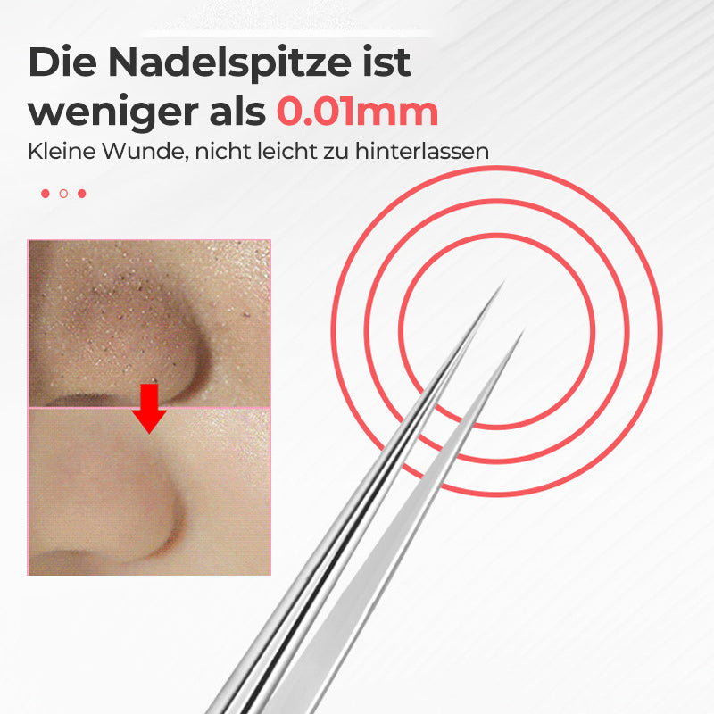 Hjemix | Pincett for å fjerne hudormer i ansiktet