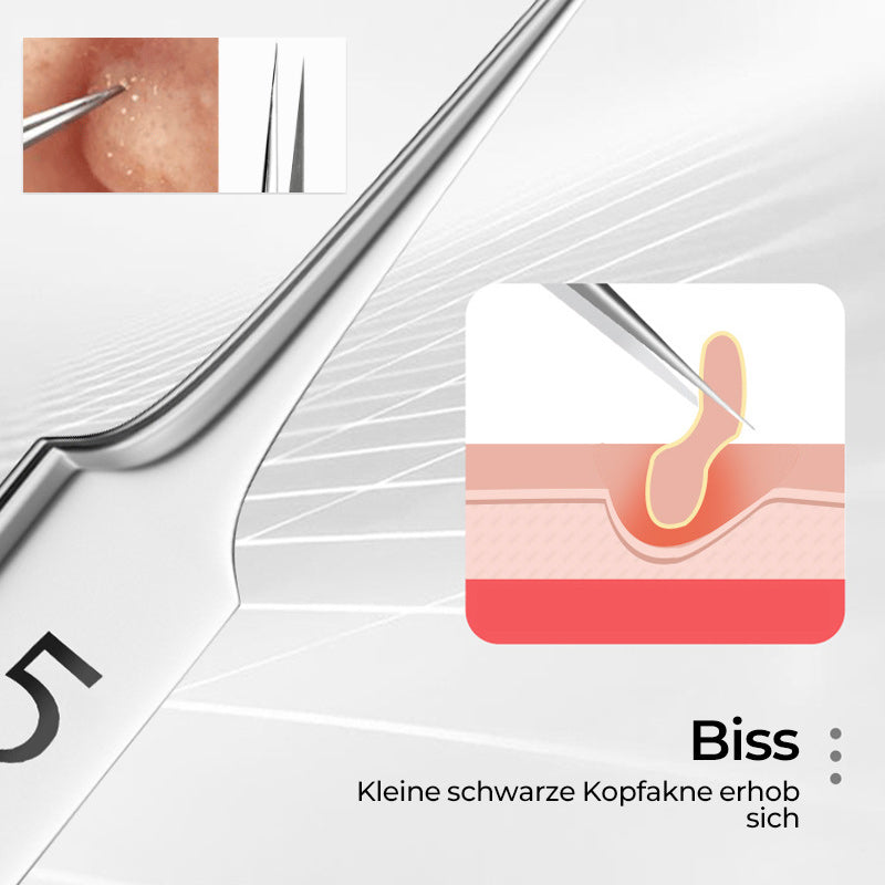 Hjemix | Pincett for å fjerne hudormer i ansiktet