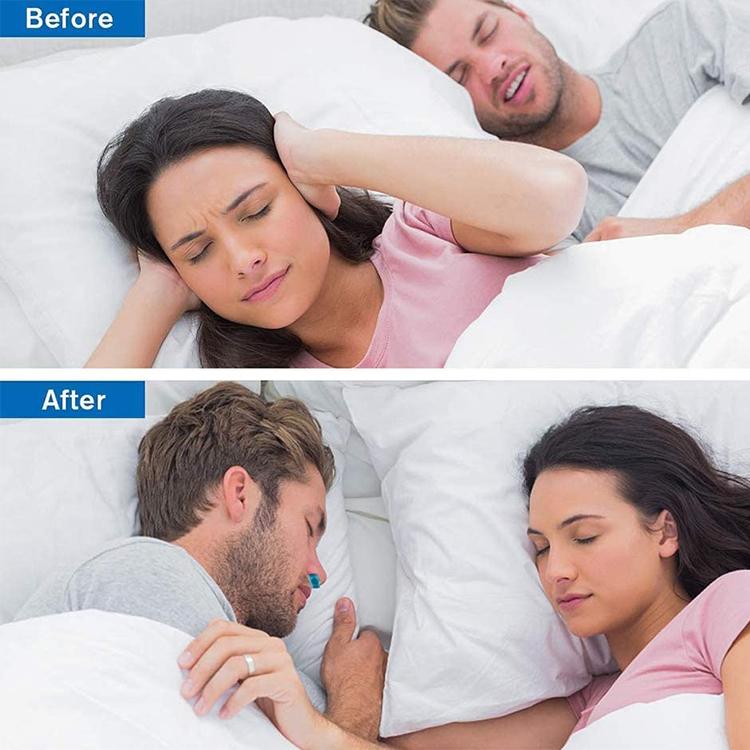 Hjemix | Micro-CPAP Anti-Snorking Enhet