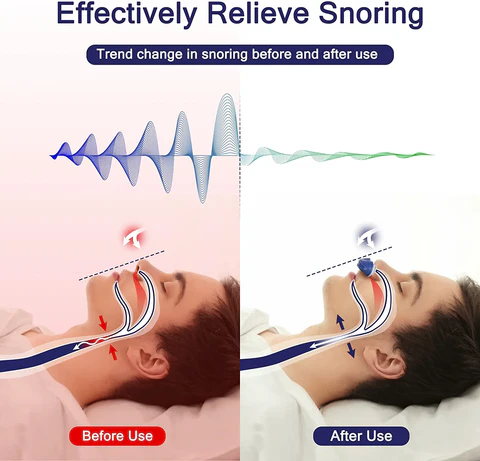 Hjemix | Micro CPAP søvnapné maskin for reise og anti-snorking - CPAP alternativ