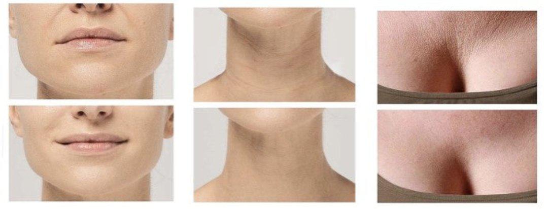 Hjemix | Anti-rynke silikonputer