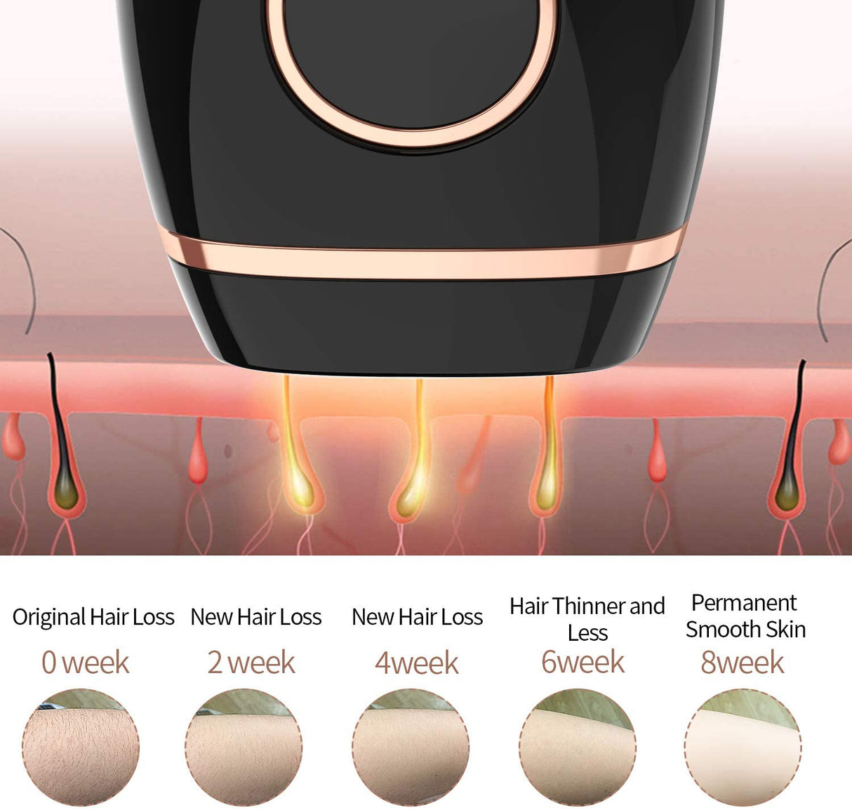 Hjemix | Hårfjerning System, Permanent Smerteløs 999,999 Blitser