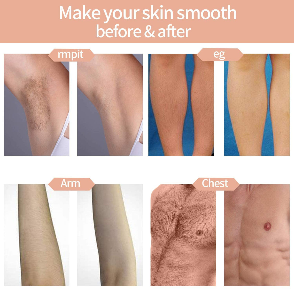 Hjemix | Hårfjerning System, Permanent Smerteløs 999,999 Blitser