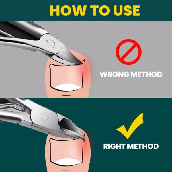 Hjemix | Orthopedisk Negleklipper