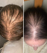 Hjemix | Håroljeapplikatorflaske