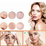 Hjemix | Rustfritt stål blackhead remover pimple popper verktøysett med metallboks