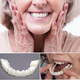 Hjemix | På Smile Veneers (Øvre og Nedre Kjeve inkludert)
