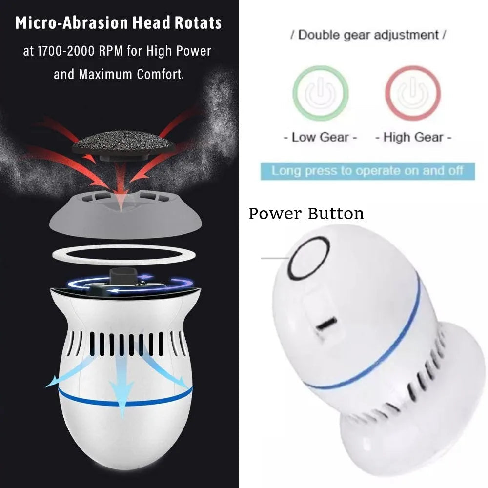 Hjemix | Vakuum Callus Fjerner