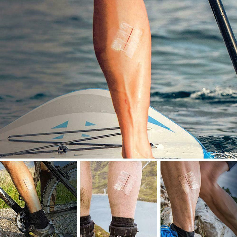 Hjemix | Utendørs Glidelås Lapp