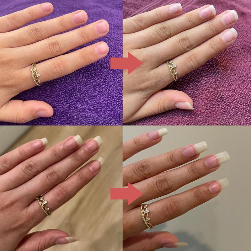 Hjemix | Nails Næringsrikt Vekstolje