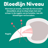 Hjemix | MAX - Beste negleklipper for hunder med hurtigsensorer