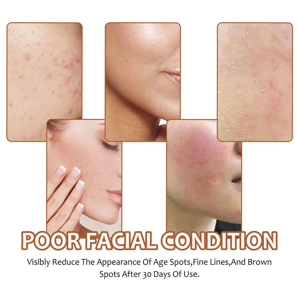 Hjemix | Sitron-Kurkuma-Kojic Syre Såpe Naturlig Opplysende Ansikts Hudpleie