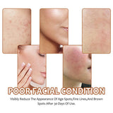 Hjemix | Sitron-Kurkuma-Kojic Syre Såpe Naturlig Opplysende Ansikts Hudpleie