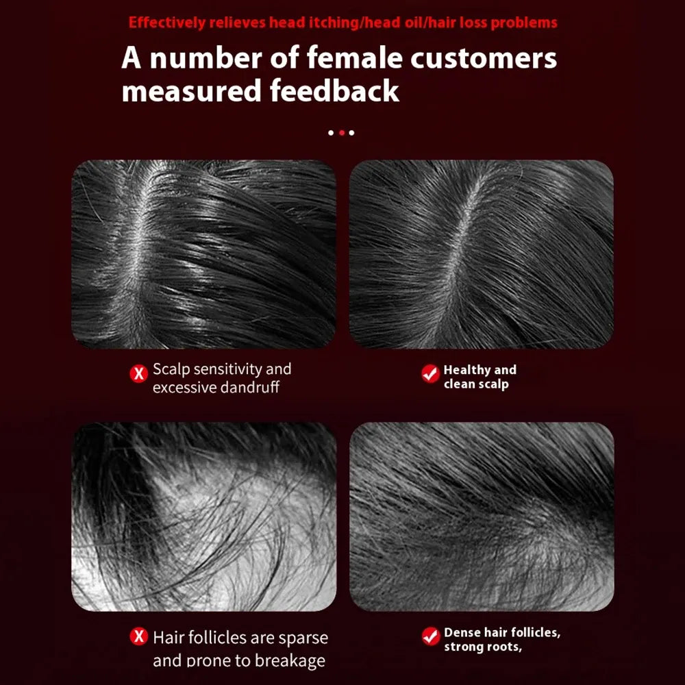 Hjemix | Massasje For Hårvekst – Styrk Håret Ditt Og Slapp Av Hodebunnen