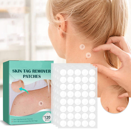 Hjemix | SkinClear - Plaster for the removal of spots and warts