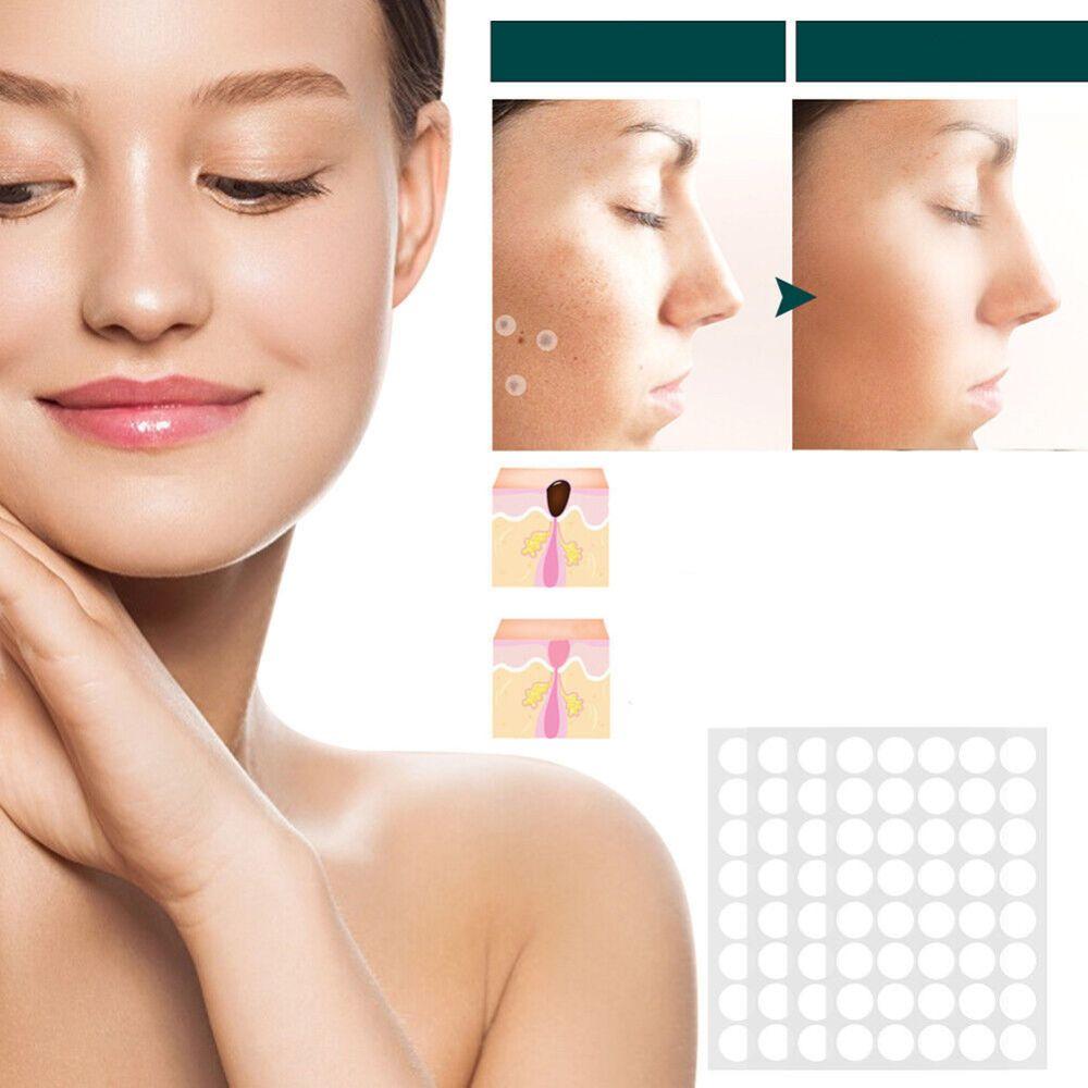 Hjemix | SkinClear - Plaster for the removal of spots and warts