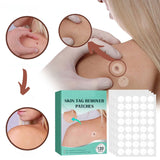 Hjemix | SkinClear - Plaster for the removal of spots and warts