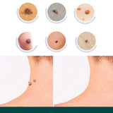 Hjemix | SkinClear - Plaster for the removal of spots and warts