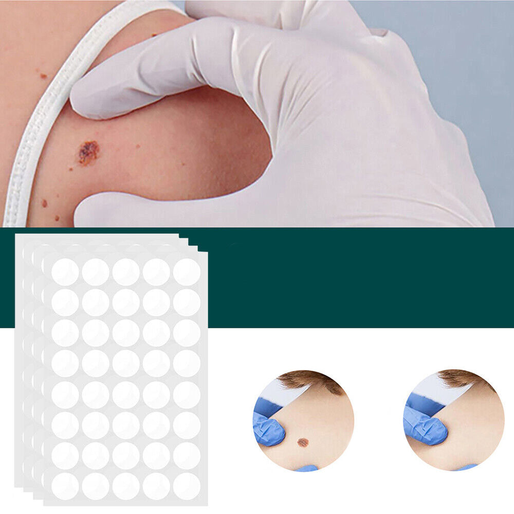 Hjemix | SkinClear - Plaster for the removal of spots and warts