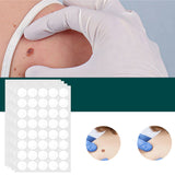 Hjemix | SkinClear - Plaster for the removal of spots and warts