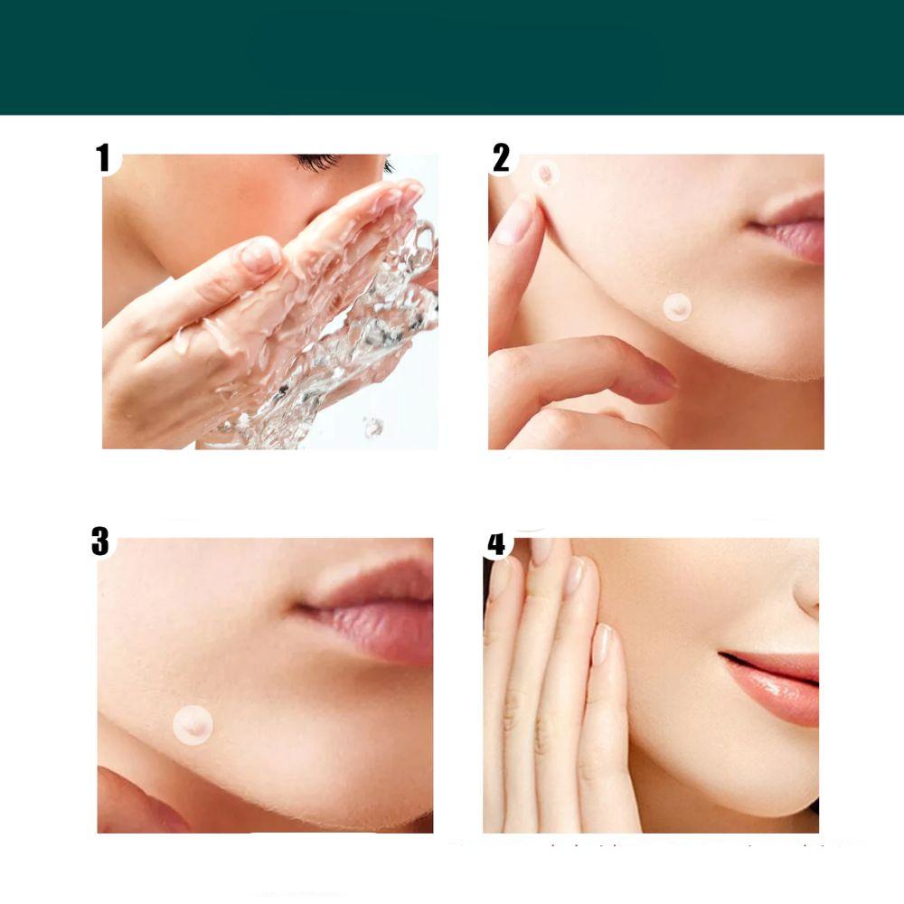 Hjemix | SkinClear - Plaster for the removal of spots and warts