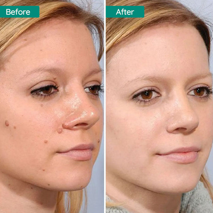 Hjemix | Flytende Gressfrø Spray