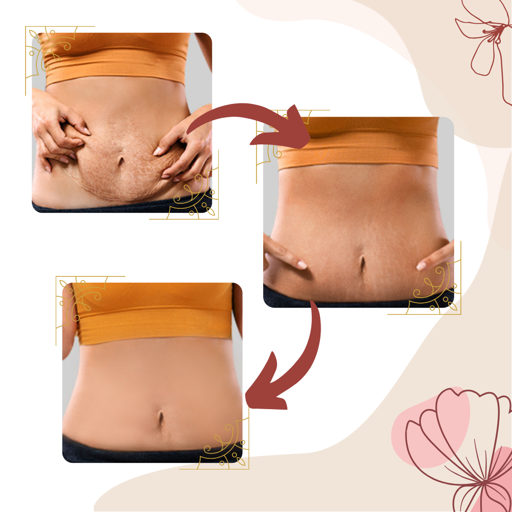 Massasjeapparat mot cellulitt med høyfrekvente vibrasjoner