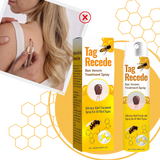 Ikke-Invasiv Fjerning av Merker