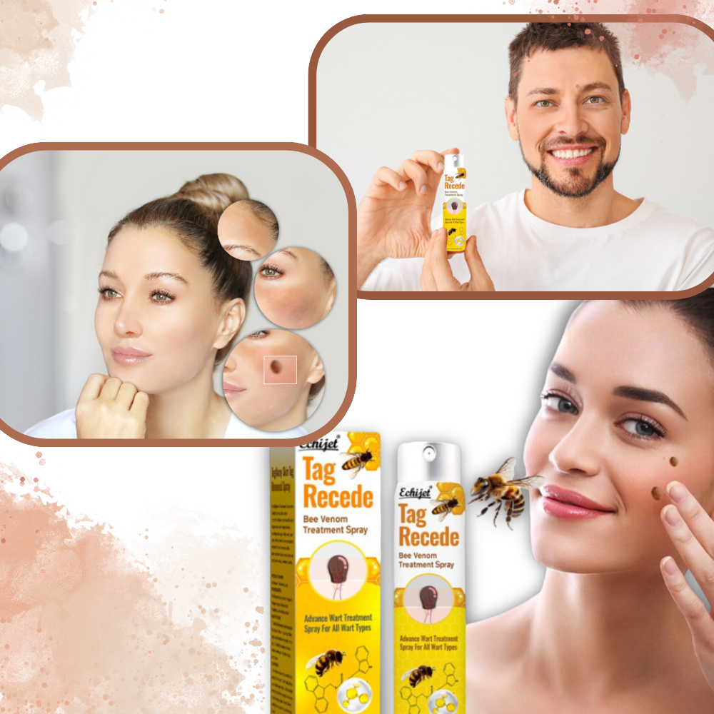 Ikke-Invasiv Fjerning av Merker