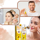 Ikke-Invasiv Fjerning av Merker