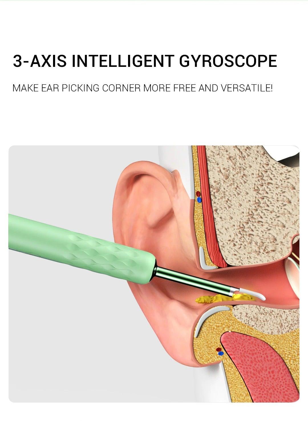 Hjemix | Smart Visuell Endoskop