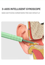 Hjemix | Smart Visuell Endoskop