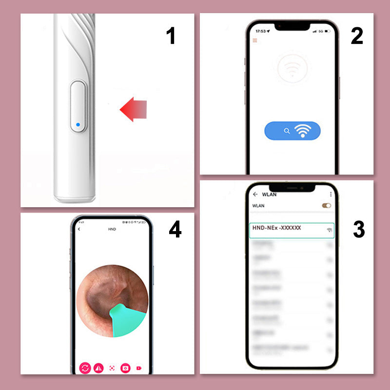 Hjemix | Apparater for fjerning av ørevoks med HD-kamera