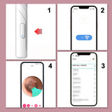 Hjemix | Apparater for fjerning av ørevoks med HD-kamera